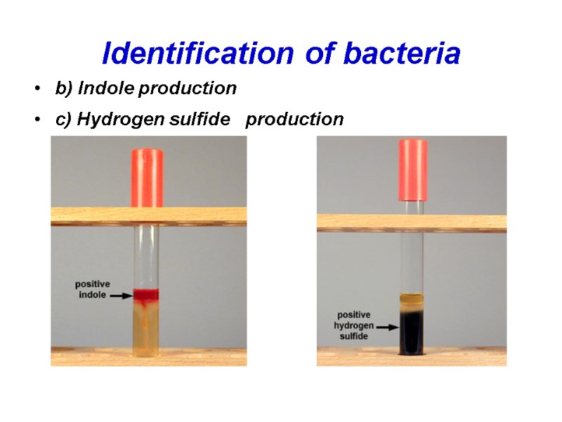 Identification of bacteria b) Indole production  c) Hydrogen sulfide   production